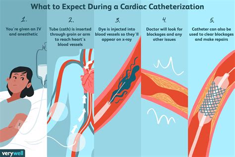 lv gram medical abbreviation|left heart catheterization without grafts.